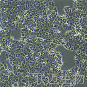 MCF7[MCF-7]细胞（乳腺癌细胞STR鉴定正确）LM8C0149,MCF7[MCF-7]