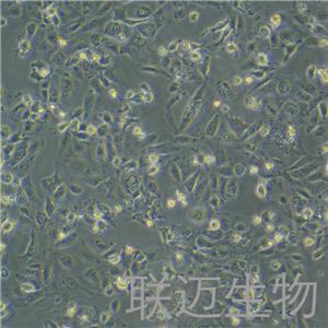 HuH-7细胞（肝癌细胞STR鉴定正确）LM8C0120