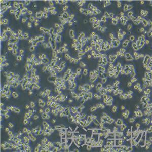 SW620细胞（结肠癌细胞STR鉴定正确）LM8C0225