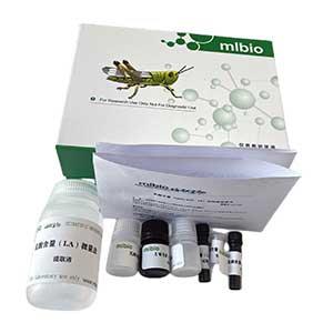 γ-谷氨酸激酶(γ-GK)试剂盒微板法/48样,γ-GK ELISA KIT