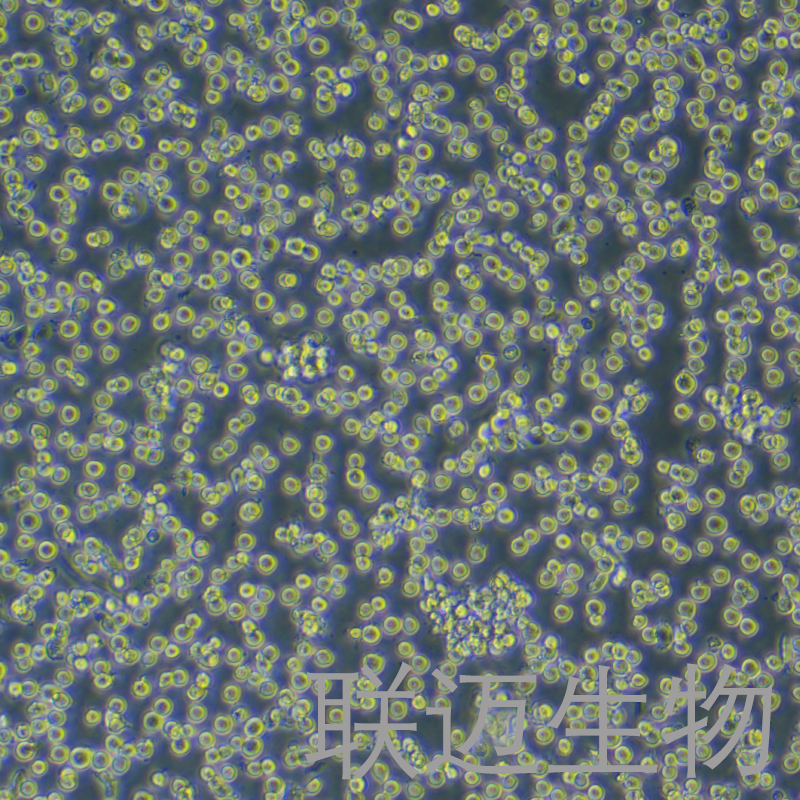 HEL细胞（红白细胞白血病细胞STR鉴定正确）LM8C0280,HEL