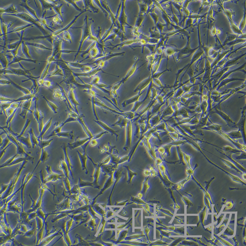 U-118MG细胞（脑星形胶质母细胞瘤STR鉴定正确）LM8C0458,U-118MG