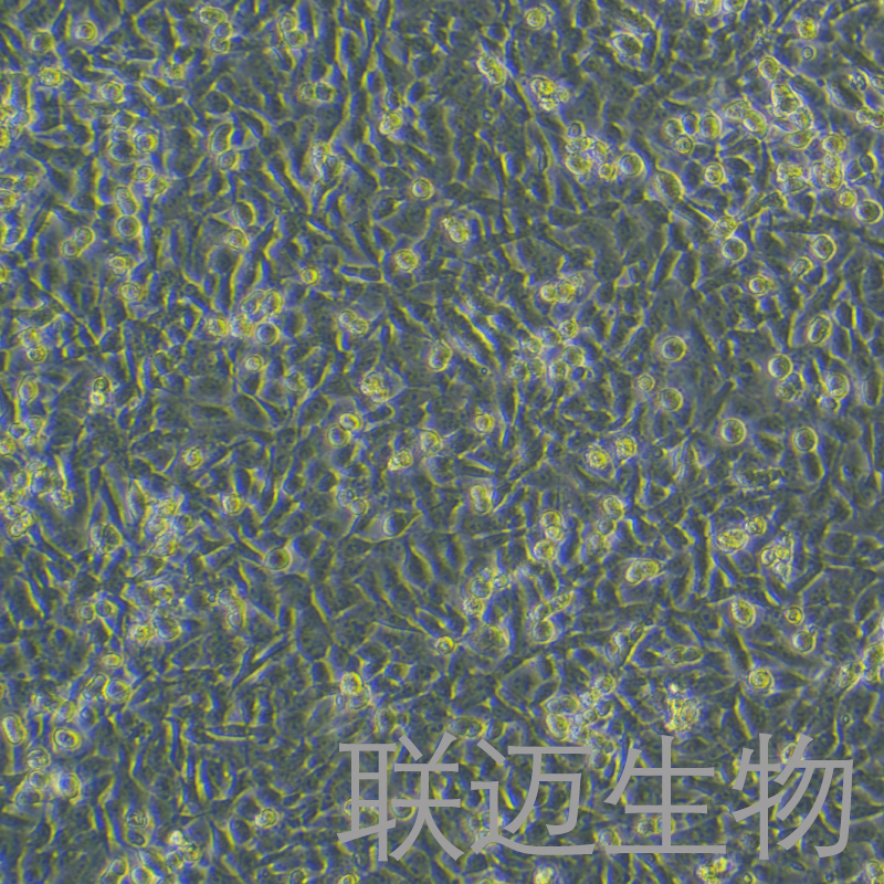 CAL-62细胞（甲状腺癌细胞未分化STR鉴定正确）LM8C0618,CAL-62