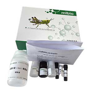 γ-谷氨酰半胱氨酸合成酶(γ-GCS)测定试剂盒/速率法/20管,γ-GCS ELISA KIT