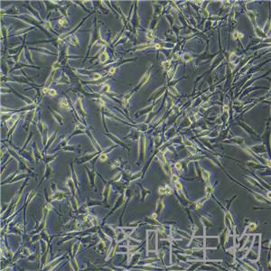 U-118MG细胞（脑星形胶质母细胞瘤STR鉴定正确）LM8C0458