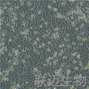 CAL-62细胞（甲状腺癌细胞未分化STR鉴定正确）LM8C0618