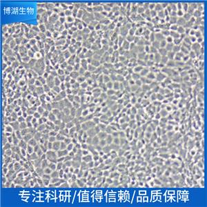 BIU-87人膀胱癌细胞,BIU-87