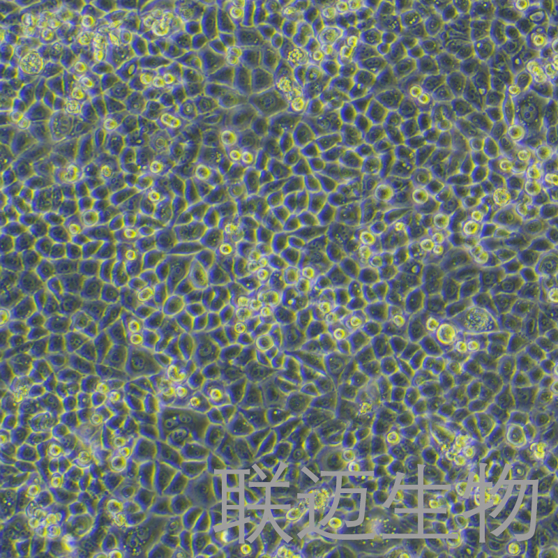 PC-9细胞（肺癌细胞STR鉴定正确）LM8C0671,PC-9