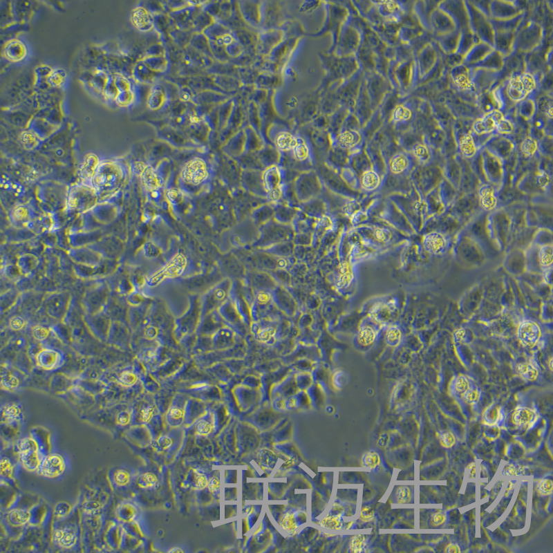 HT-1376细胞（膀胱癌细胞（STR鉴定正确））LM8C0672,HT-1376