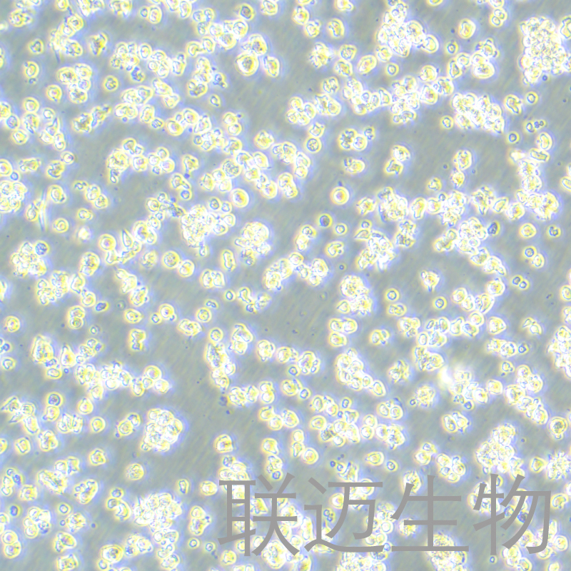EL4细胞（小鼠淋巴瘤细胞）LM8C0078,EL4