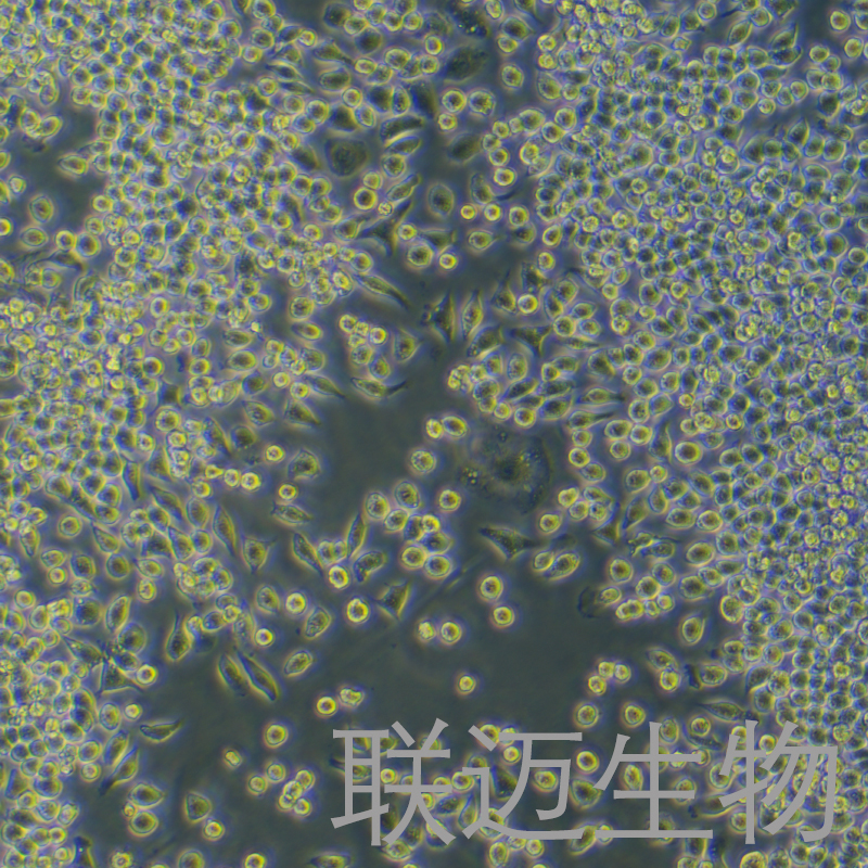 J774A.1细胞（小鼠单核巨噬细胞）LM8C0370,J774A.1