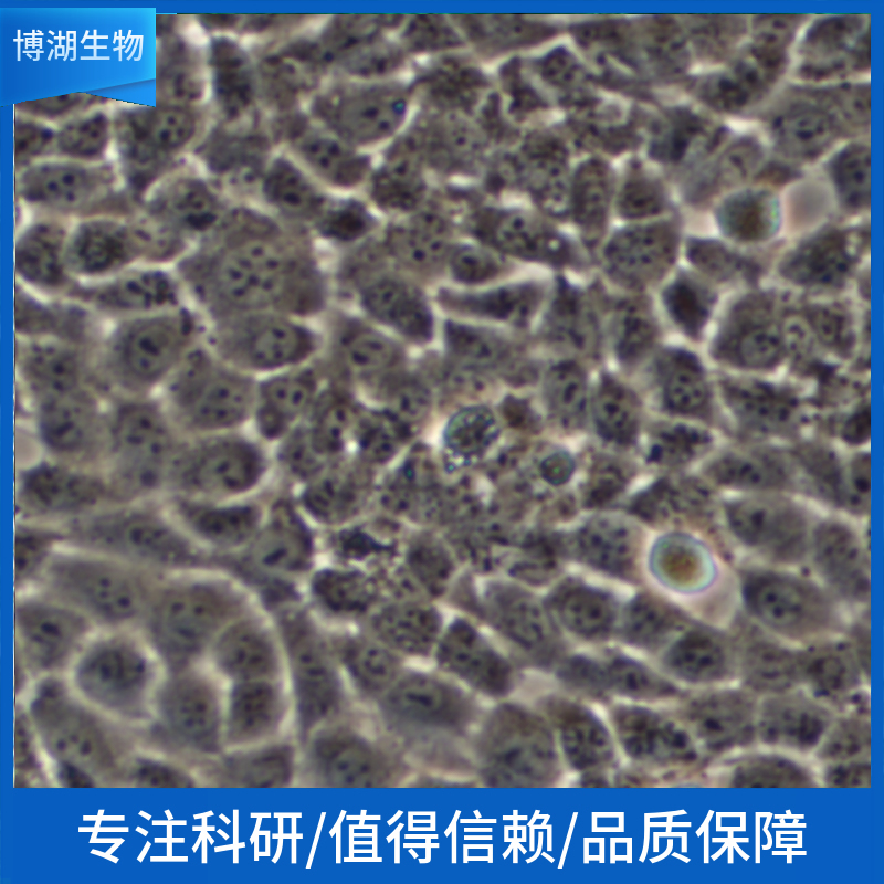 MDA-MB-468人乳腺癌细胞,MDA-MB-468