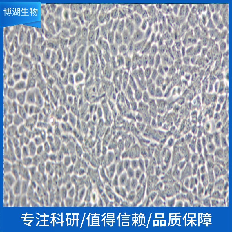 MDA-MB-231人乳腺癌细胞,MDA-MB-231