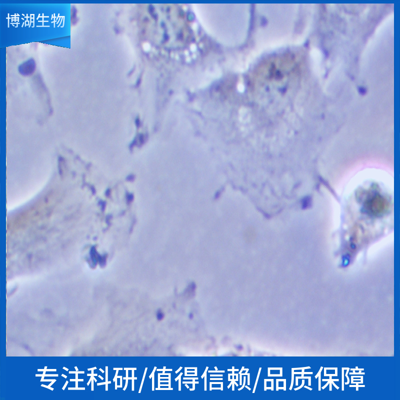 MDA-MB-231-EGFP-LUC;人三阴性乳腺癌绿色荧光蛋白-荧光素酶标记,MDA-MB-231-EGFP-LUC