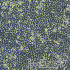 PC-9细胞（肺癌细胞STR鉴定正确）LM8C0671