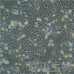 HT-1376细胞（膀胱癌细胞（STR鉴定正确））LM8C0672,HT-1376