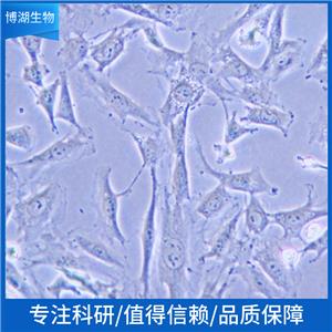 HCT-8/LUC (STR)人结肠癌细胞带荧光素酶,HCT-8/LUC