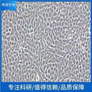 MDA-MB-231人乳腺癌细胞