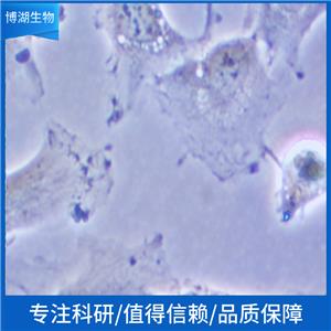 MDA-MB-231-EGFP-LUC;人三阴性乳腺癌绿色荧光蛋白-荧光素酶标记