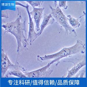 MKN-45-eGFP-LUC；人胃癌细胞-绿色荧光蛋白-荧光素酶标记