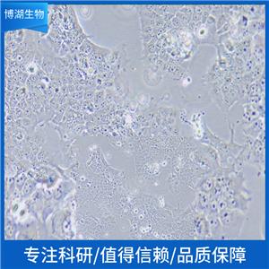 Jurkat（clone E6-1）人T淋巴细胞白血病细胞