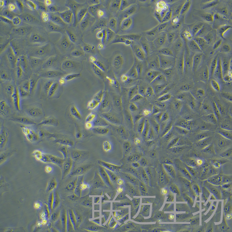 VEROC1008[VeroE6]细胞（非洲绿猴肾细胞） LM8C0491,VEROC1008[VeroE6]