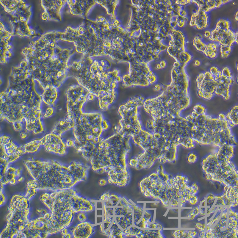 T84细胞（结肠腺癌肺转移细胞STR鉴定正确）LM8C0229,T84