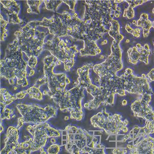 T84细胞（结肠腺癌肺转移细胞STR鉴定正确）LM8C0229