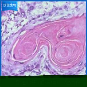 胃癌细胞+luc;AGS-plv-luc-puro