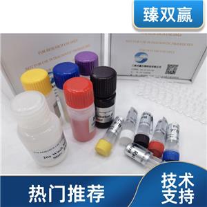 人KI67抗原(Ki67)ELISA试剂盒,Human Ki67 ELISA KIT