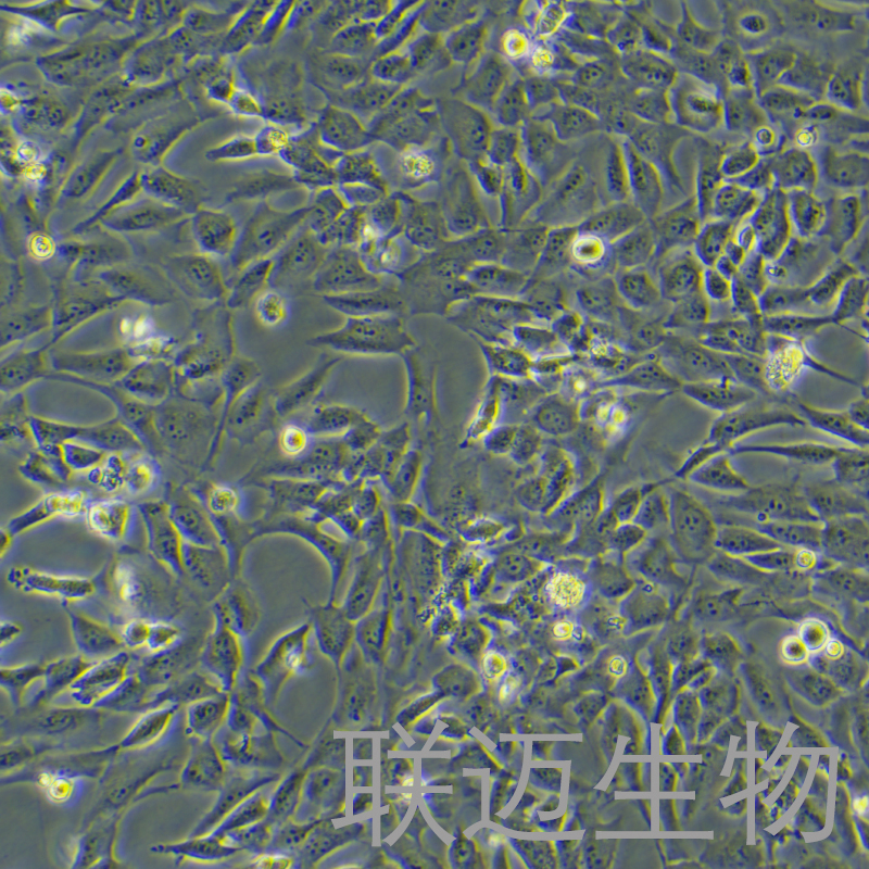 WPMY-1细胞（正常前列腺基质永生化细胞STR鉴定正确）LM8C0467,WPMY-1