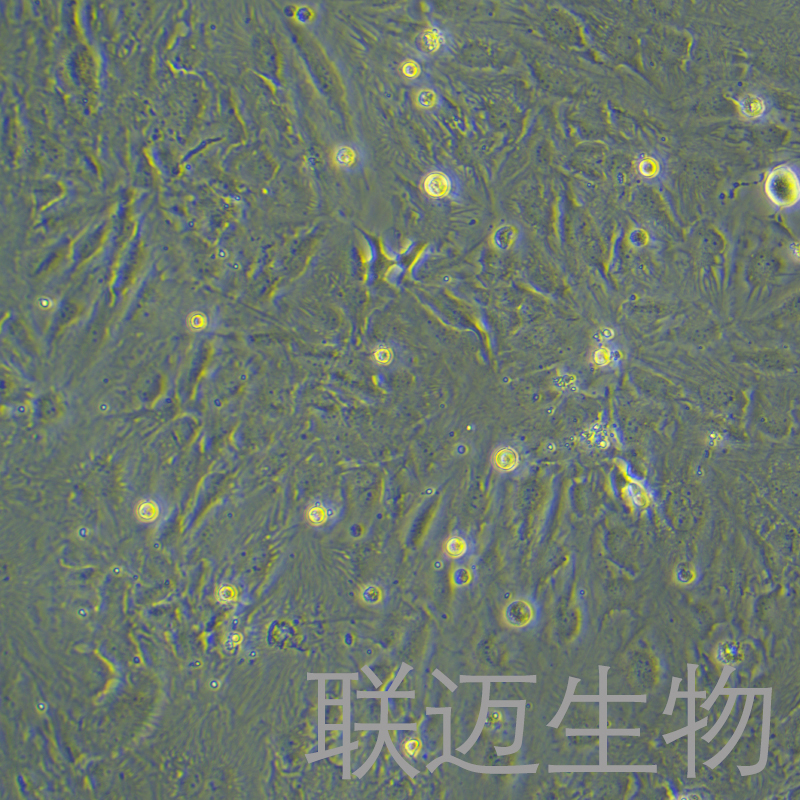 SNU-387细胞（肝癌细胞STR鉴定正确）LM8C0612,SNU-387