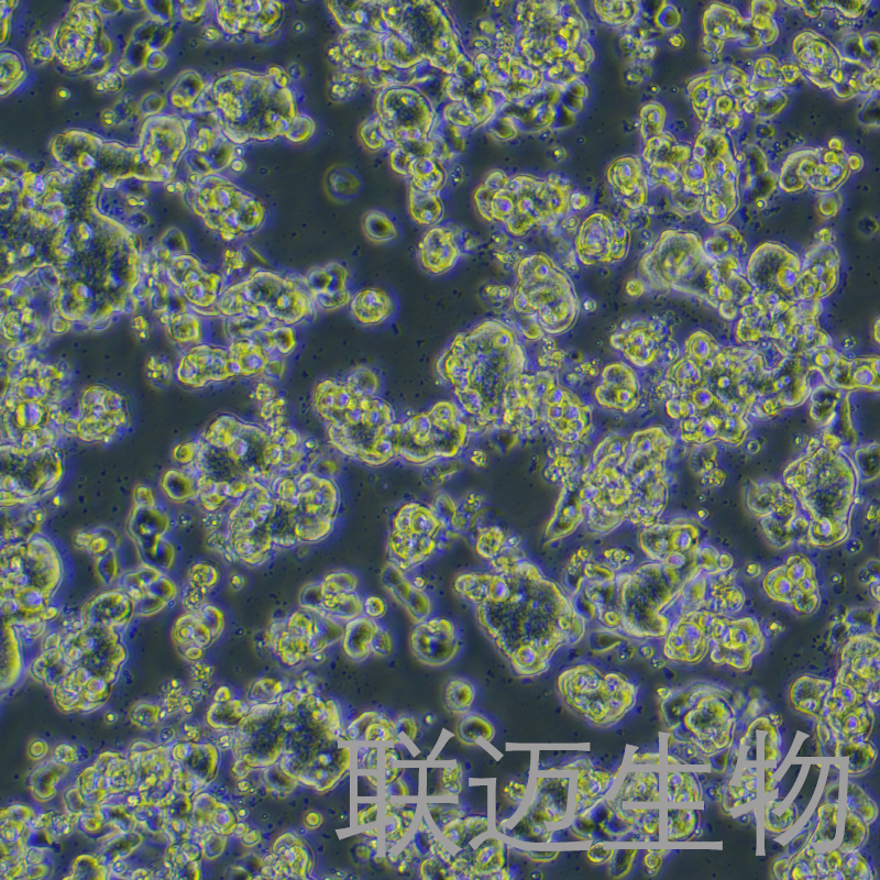 LS513细胞（结直肠癌细胞STR鉴定正确）LM8C0640,LS513