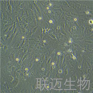 SNU-387细胞（肝癌细胞STR鉴定正确）LM8C0612