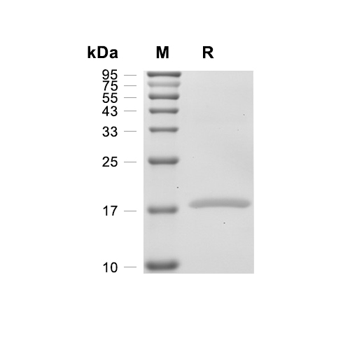 IL-1 beta蛋白, Rat,IL-1 beta Protein, Rat