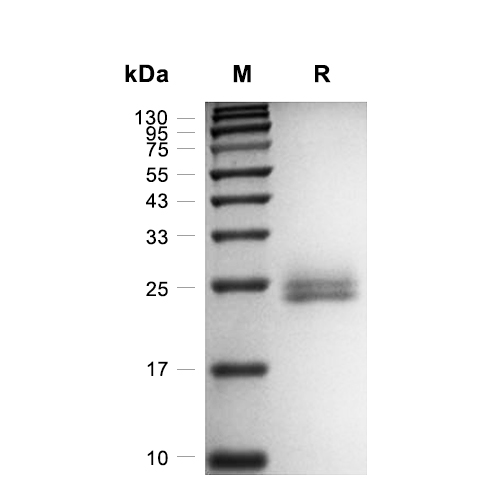 IL-6蛋白, Mouse (CHO, His),IL-6 Protein, Mouse (CHO, His)