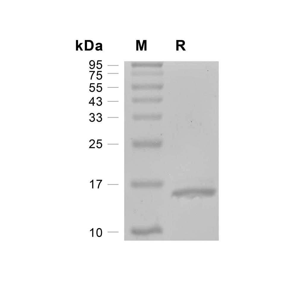 IL-22蛋白, Mouse,IL-22 Protein, Mouse