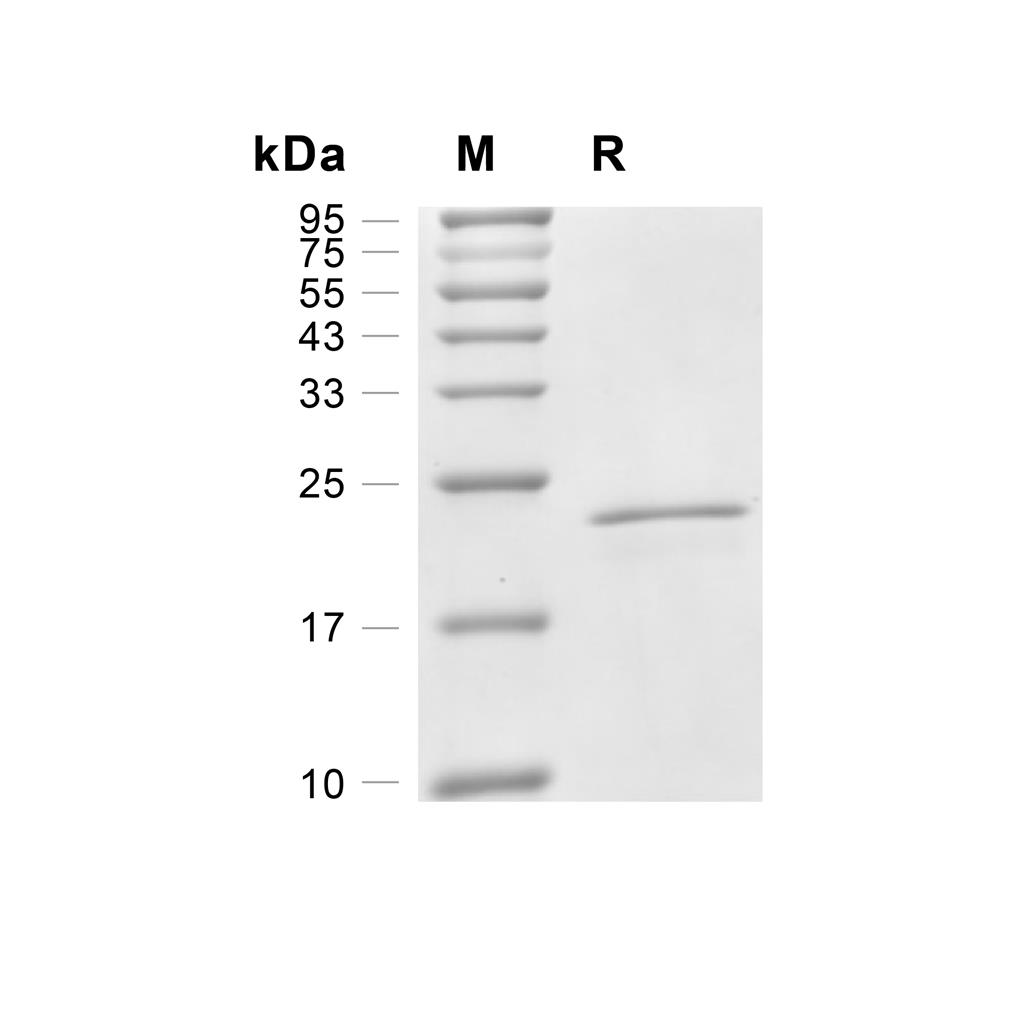 SHH蛋白, Mouse,SHH Protein, Mouse
