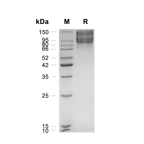 LDLR蛋白, Human (HEK293, His),LDLR Protein, Human (HEK293, His)