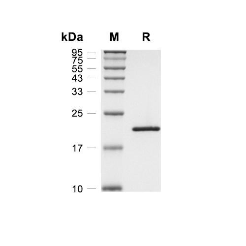 IHH蛋白, Human,IHH Protein, Human