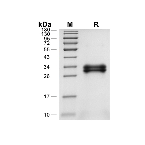 G-CSF蛋白, Rat (HEK293),G-CSF Protein, Rat (HEK293)