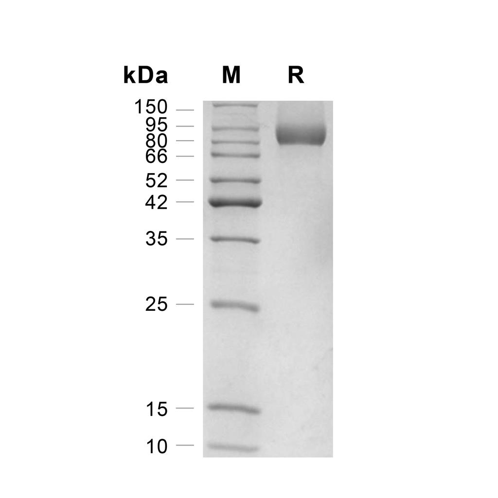 Neuropilin-1蛋白, Human (HEK293, His),Neuropilin-1 Protein, Human (HEK293, His)