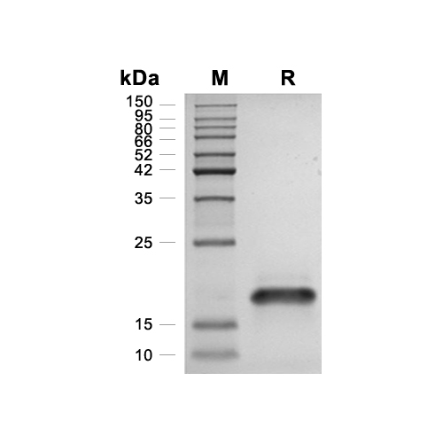 Exodus-2/CCL21蛋白, Human,Exodus-2/CCL21 Protein, Human