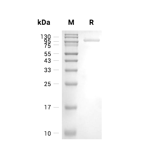 Complement Factor B/CFB蛋白, Human (HEK293, His),Complement Factor B/CFB Protein, Human (HEK293, His)