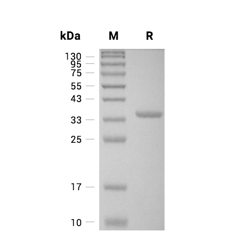 Arginase-2/ARG2蛋白, Human (His),Arginase-2/ARG2 Protein, Human (His)