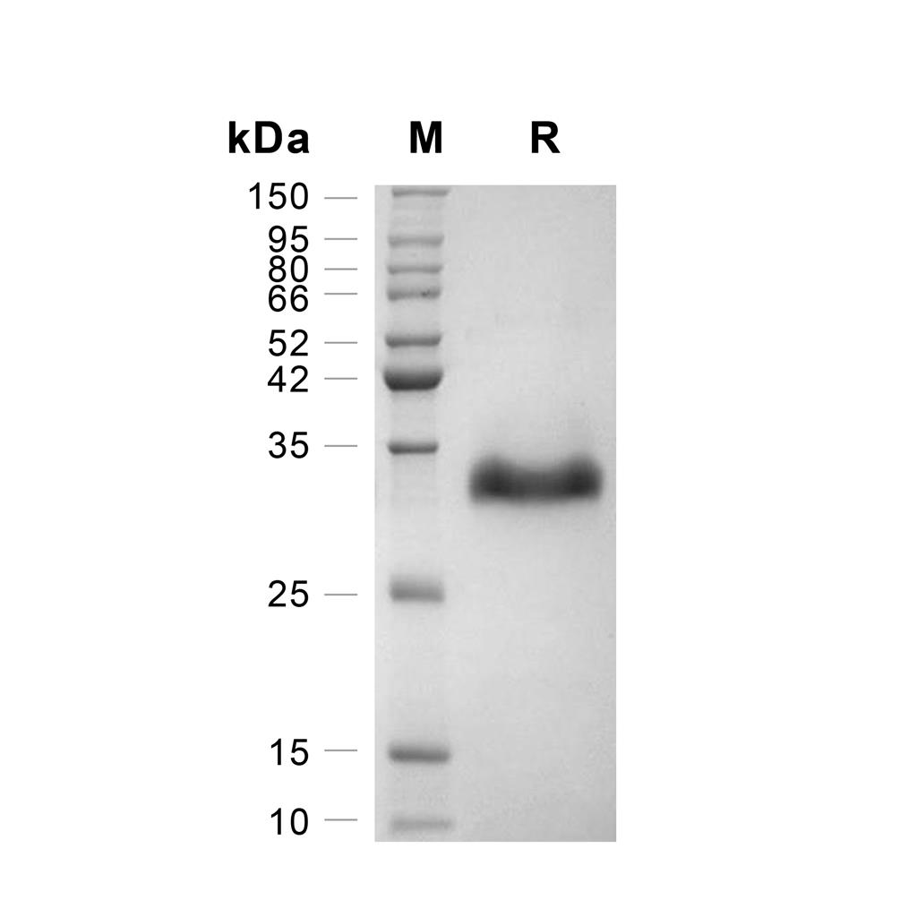 Angiopoietin-2蛋白, Human (222a.a, HEK293, His),Angiopoietin-2 Protein, Human (222a.a, HEK293, His)