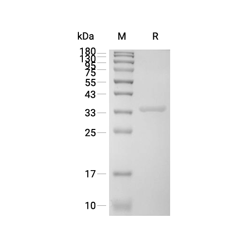 Annexin A13/ANXA13蛋白, Human,Annexin A13/ANXA13 Protein, Human