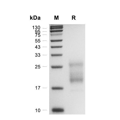 Irisin蛋白, Human/Mouse/Rat (HEK293, His),Irisin Protein, Human/Mouse/Rat (HEK293, His)