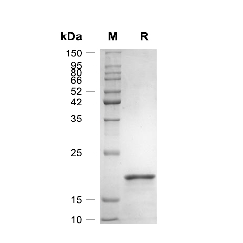 IL-18蛋白, Human,IL-18 Protein, Human