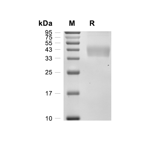 TGF beta 1/TGFB1 LAP蛋白, Human (HEK293),TGF beta 1/TGFB1 LAP Protein, Human (HEK293)